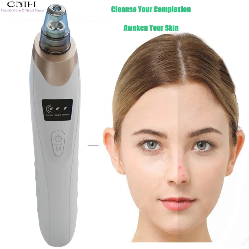 Blackhead Remover Pore Vacuum